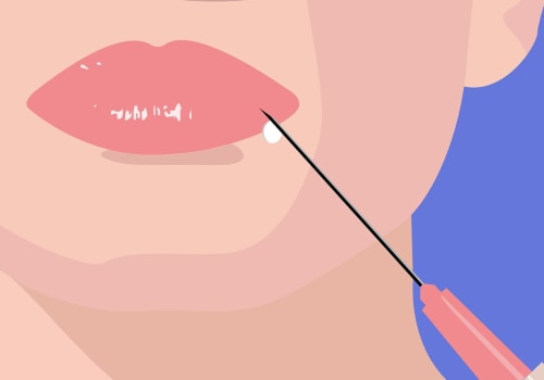 Which Facial Fillers are the Best for You?