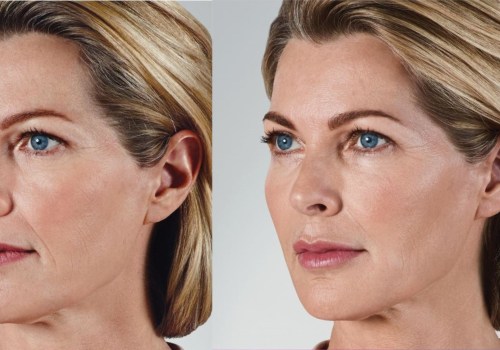 Enhance your facial appearance with Skin Savvy USA Premium Injectable fillers