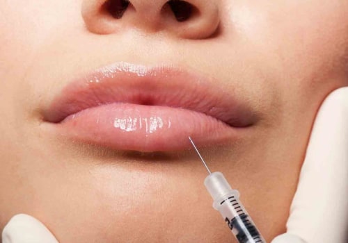 Are Facial Fillers Painful? An Expert's Perspective